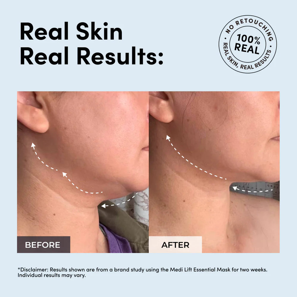 V-Face EMS Facial Lifting Mask | Jawline, Skin Tightening & Wrinkle Reduction