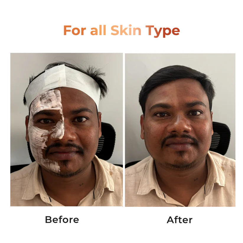 Instant Tan Removal Skin Polish | Kojic Acid & Glutathione 180g (₹45 per use)