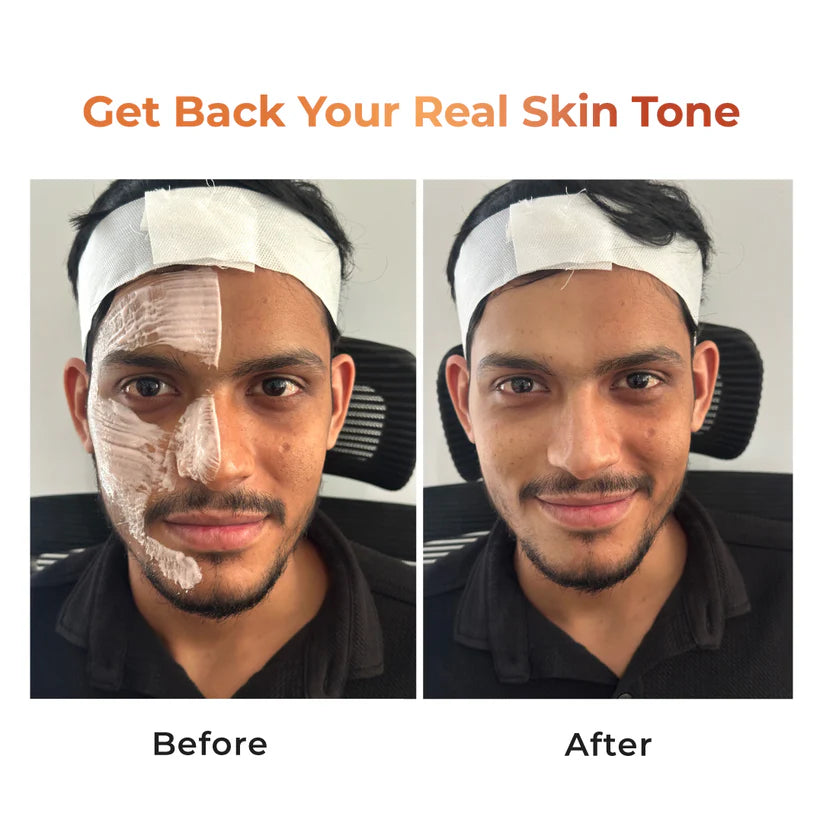 Instant Tan Removal Skin Polish | Kojic Acid & Glutathione 180g (₹45 per use)