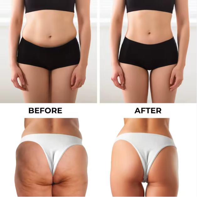 SCULPTA™ EMS Toning Shorts